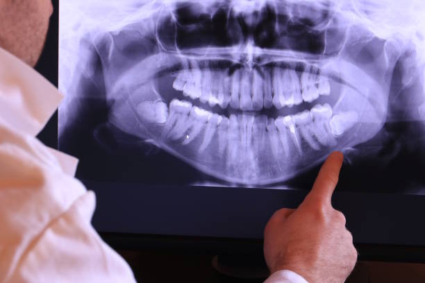 Best Dentist for Tooth Abscess  in Stevensville, MD